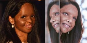 laxmi Agarwal Chhapaak